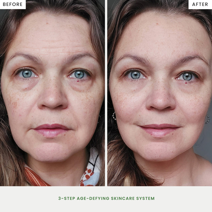 3-Step Age-Defying Skincare System